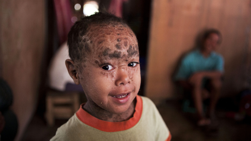 Аномалии тела